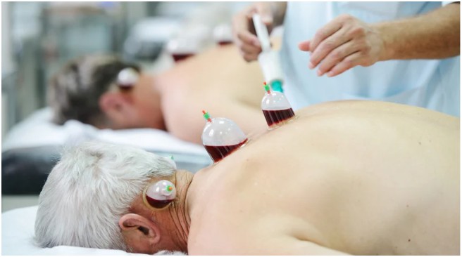 Is Hijama Suitable for Everyone?