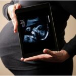 Ensuring a Healthy Journey: The Importance of Pregnancy Ultrasounds in Sydney