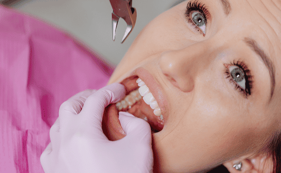 Planning Your Wisdom Teeth Extraction What to Expect from Initial Evaluation to Surgery