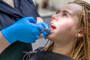Why Orthodontic Relapse Happens and How to Prevent It