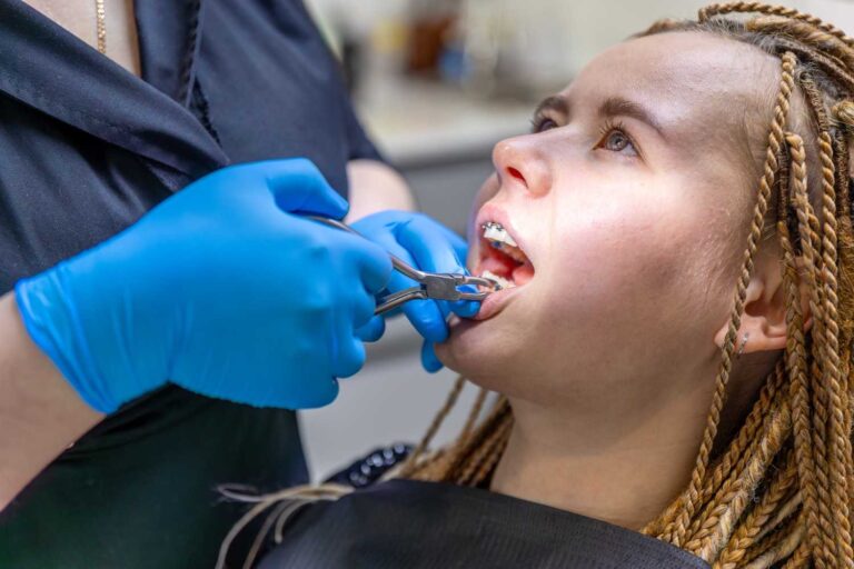 Why Orthodontic Relapse Happens and How to Prevent It